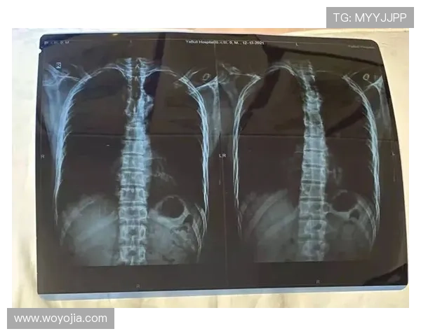 全方位深入解析滑雪技巧装备选择与安全要点及新手进阶实用指南全